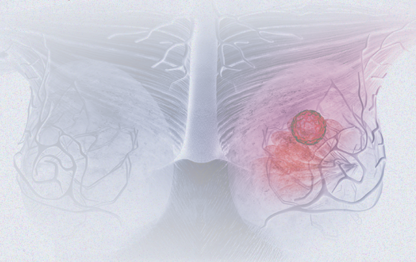 国际妇女节 | 关注乳腺癌 微创介入让美丽继续,「乳」愿以偿正成为现实
